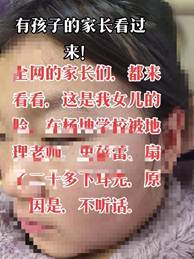河南通许:初一女生被老师打伤住院，当事主管竟然还在包庇